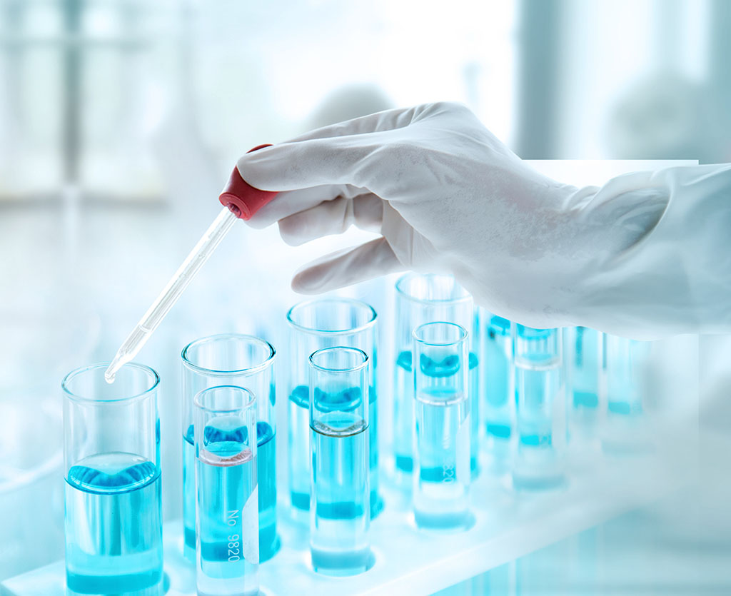 Test Tubes With Liquid In Laboratory, Doctor Hand Holding Droppe